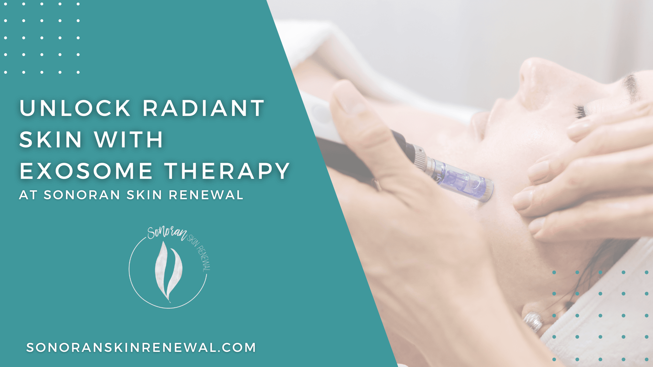 Exosome Therapy