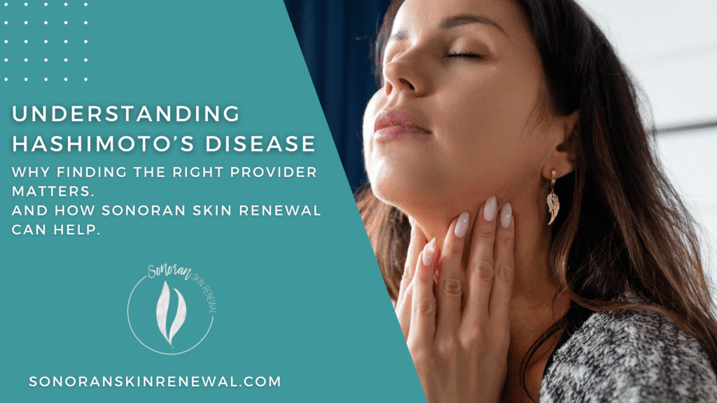 Hashitmoto's Disease