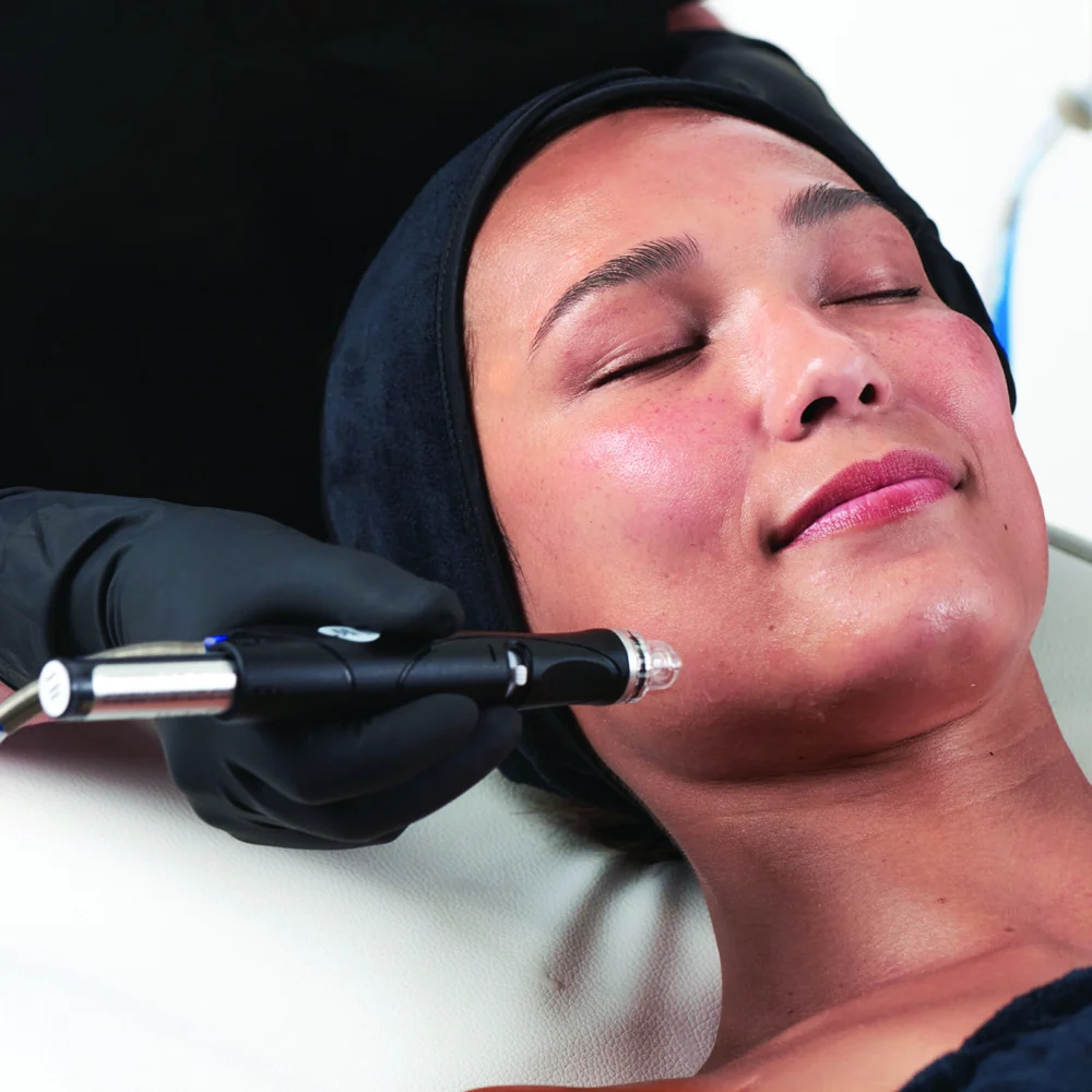 Esthetician performing a Hydrafacial Skin Radiance treatment in Scottsdale, AZ